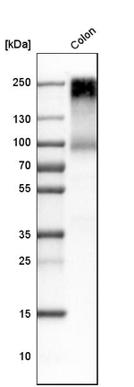 CEA Antibody in Western Blot (WB)