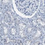 Kallikrein 15 Antibody in Immunohistochemistry (Paraffin) (IHC (P))