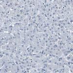 Kallikrein 15 Antibody in Immunohistochemistry (Paraffin) (IHC (P))