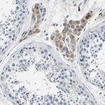 Kallikrein 15 Antibody in Immunohistochemistry (Paraffin) (IHC (P))