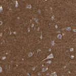 Amphiphysin Antibody in Immunohistochemistry (Paraffin) (IHC (P))
