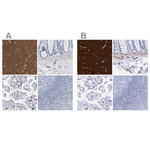Amphiphysin Antibody in Immunohistochemistry (Paraffin) (IHC (P))