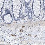 Amphiphysin Antibody in Immunohistochemistry (Paraffin) (IHC (P))