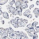 Amphiphysin Antibody in Immunohistochemistry (Paraffin) (IHC (P))