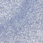 Amphiphysin Antibody in Immunohistochemistry (Paraffin) (IHC (P))
