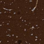 Amphiphysin Antibody in Immunohistochemistry (Paraffin) (IHC (P))