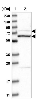 Amphiphysin Antibody in Western Blot (WB)