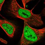 NuMA Polyclonal Antibody