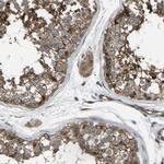 GAS2L1 Antibody in Immunohistochemistry (Paraffin) (IHC (P))