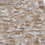 GAS2L1 Antibody in Immunohistochemistry (Paraffin) (IHC (P))