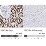 THEM2 Antibody in Immunohistochemistry (Paraffin) (IHC (P))