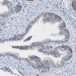 THEM2 Antibody in Immunohistochemistry (Paraffin) (IHC (P))
