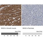 BAG2 Antibody
