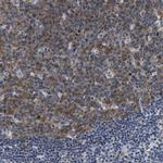 BAG2 Antibody in Immunohistochemistry (Paraffin) (IHC (P))