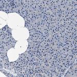 BAG2 Antibody in Immunohistochemistry (Paraffin) (IHC (P))