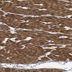 BAG2 Antibody in Immunohistochemistry (Paraffin) (IHC (P))