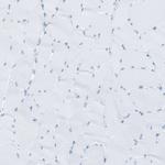 RyR2 Antibody in Immunohistochemistry (Paraffin) (IHC (P))