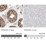 LIS1 Antibody in Immunohistochemistry (Paraffin) (IHC (P))