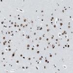 DDX5 Antibody in Immunohistochemistry (Paraffin) (IHC (P))