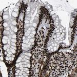 DDX5 Antibody in Immunohistochemistry (Paraffin) (IHC (P))