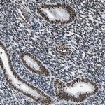 DDX5 Antibody in Immunohistochemistry (Paraffin) (IHC (P))