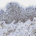 DDX5 Antibody in Immunohistochemistry (Paraffin) (IHC (P))
