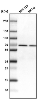 DDX5 Antibody in Western Blot (WB)