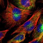 DUSP8 Polyclonal Antibody