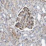 DUSP8 Antibody in Immunohistochemistry (Paraffin) (IHC (P))