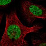 SAFB Polyclonal Antibody