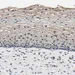 SAFB Antibody in Immunohistochemistry (Paraffin) (IHC (P))