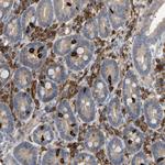 PLCG2 Polyclonal Antibody
