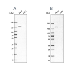 PLCG2 Antibody in Western Blot (WB)
