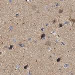 HIP55 Antibody in Immunohistochemistry (Paraffin) (IHC (P))