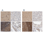 HIP55 Polyclonal Antibody