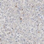 HIP55 Antibody in Immunohistochemistry (Paraffin) (IHC (P))