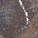 HIP55 Antibody in Immunohistochemistry (Paraffin) (IHC (P))