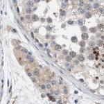 HIP55 Antibody in Immunohistochemistry (Paraffin) (IHC (P))