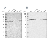 HIP55 Antibody in Western Blot (WB)