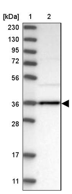 AKR1B10 Antibody in Western Blot (WB)
