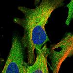 AAK1 Polyclonal Antibody