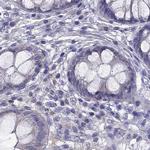 AAK1 Antibody in Immunohistochemistry (Paraffin) (IHC (P))
