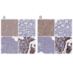 AAK1 Antibody in Immunohistochemistry (Paraffin) (IHC (P))
