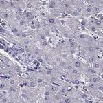 AAK1 Antibody in Immunohistochemistry (Paraffin) (IHC (P))