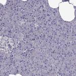 AAK1 Antibody in Immunohistochemistry (Paraffin) (IHC (P))