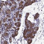 AAK1 Antibody in Immunohistochemistry (Paraffin) (IHC (P))