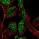 Carboxypeptidase A5 Polyclonal Antibody