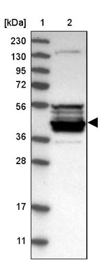 Carboxypeptidase A5 Antibody in Western Blot (WB)