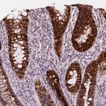 DUSP16 Antibody in Immunohistochemistry (Paraffin) (IHC (P))