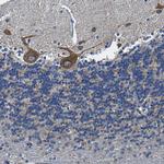 SLC25A25 Antibody in Immunohistochemistry (Paraffin) (IHC (P))